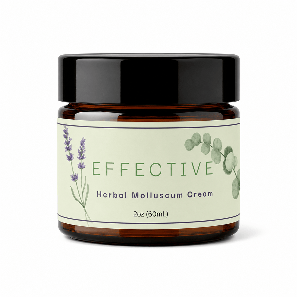 EFFECTIVE – Herbal Molluscum Cream, All-Natural Relief from Molluscum (2 oz / 60 ml)